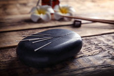 All about acupuncture