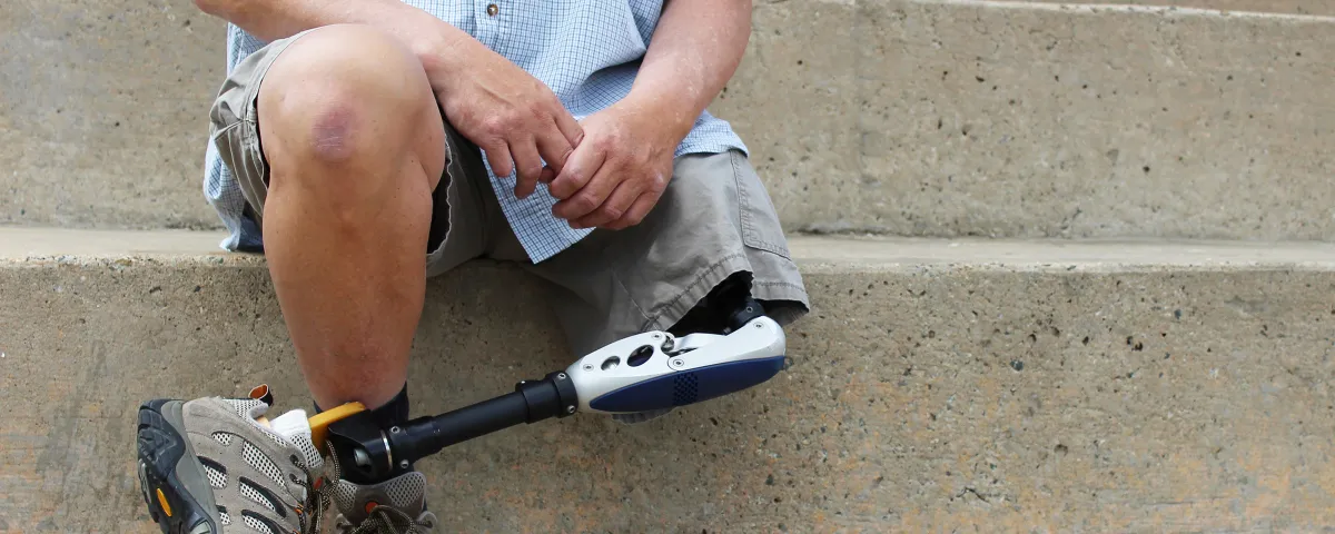 Man with prosthetic leg sitting on stairs