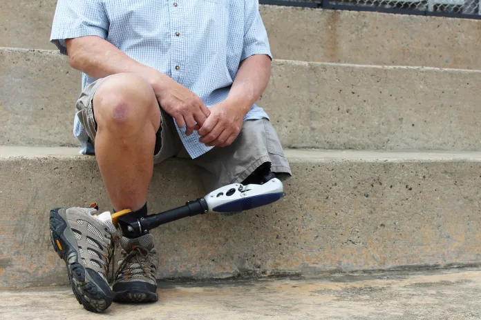 Man with prosthetic leg sitting on stairs