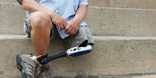 Man with prosthetic leg sitting on stairs